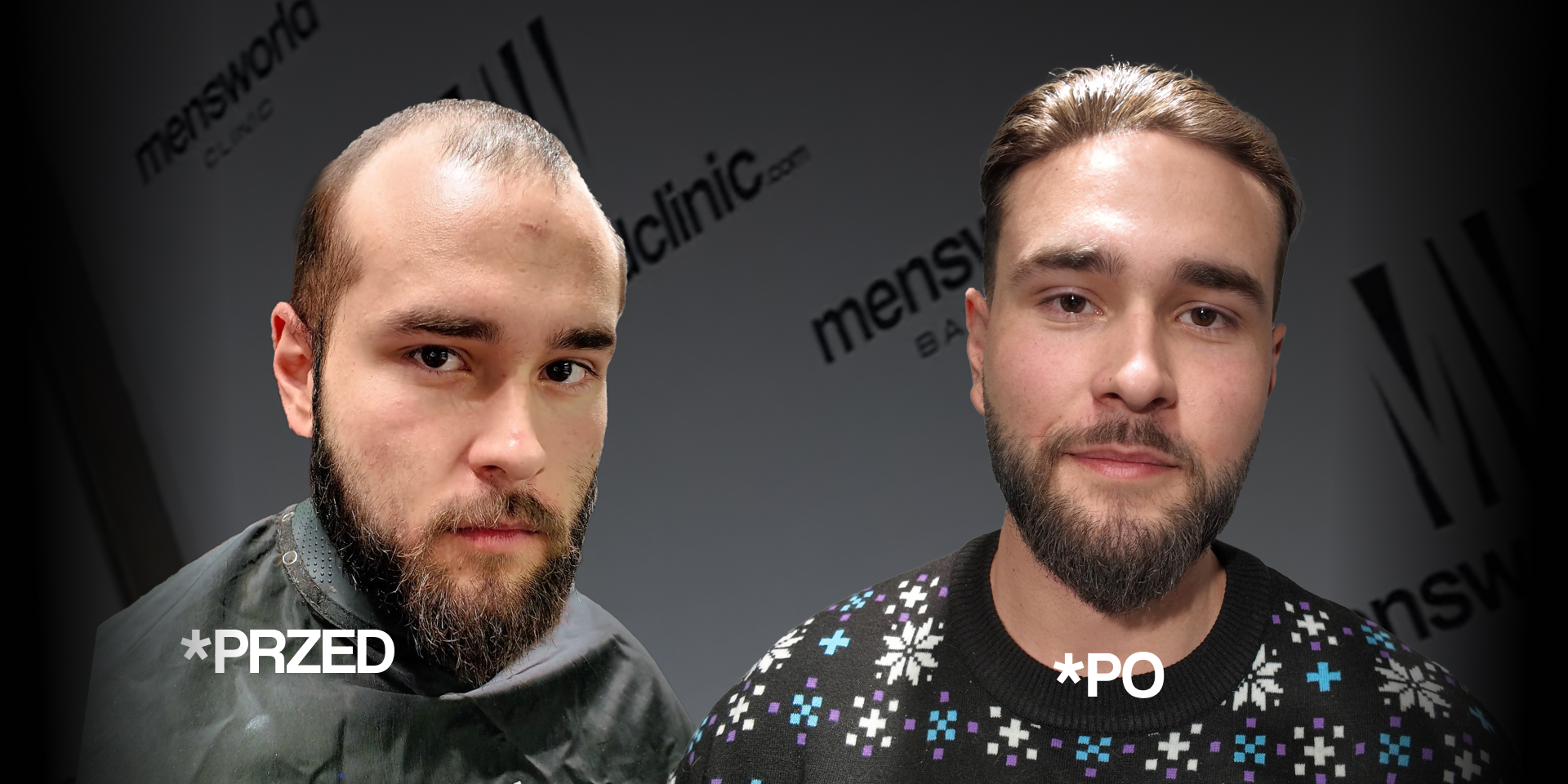 Porównanie efektów