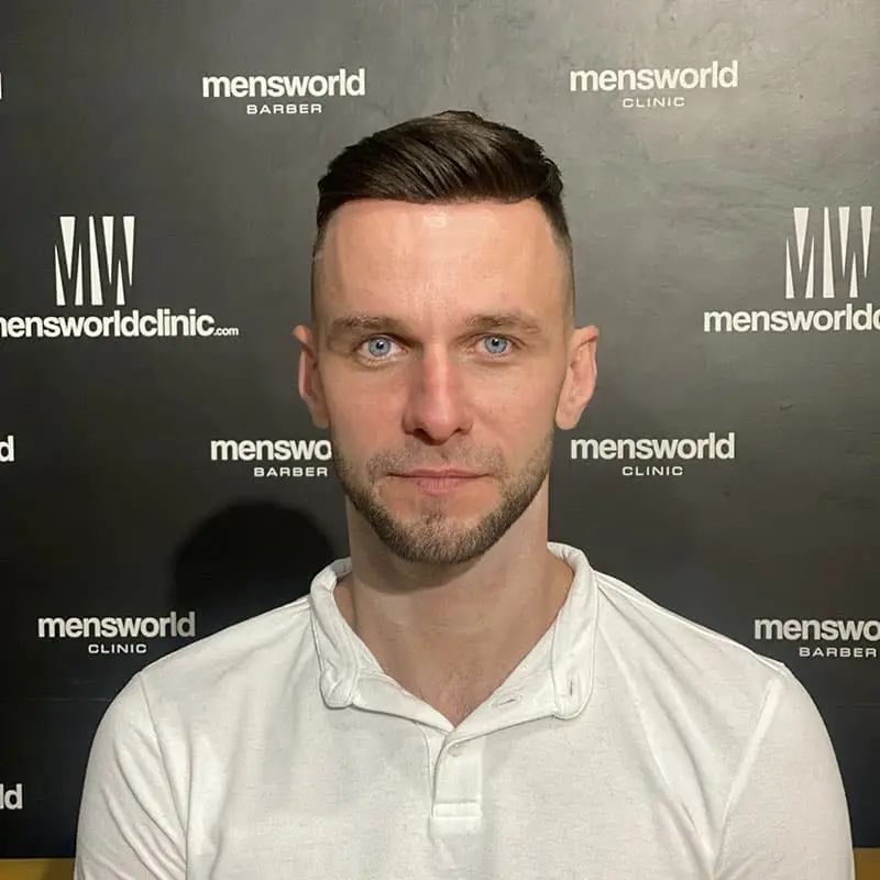 Nowoczesny system włosów