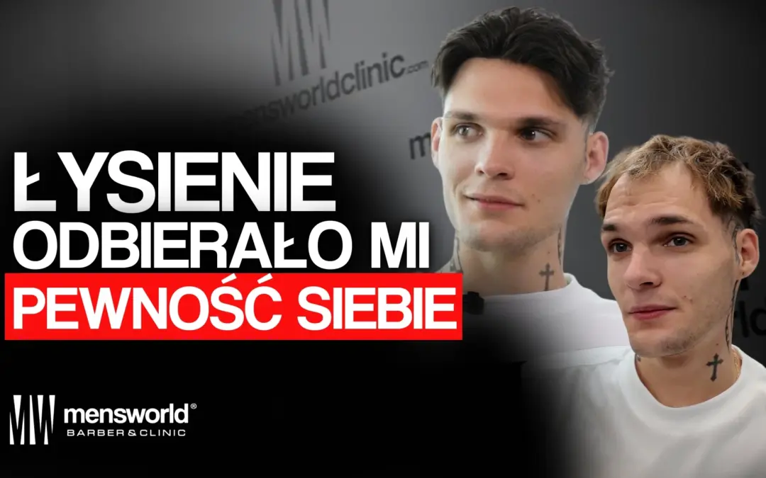 Życie pod czapką i ukrywanie zakoli. Dlaczego Leszek odrzucił przeszczep?