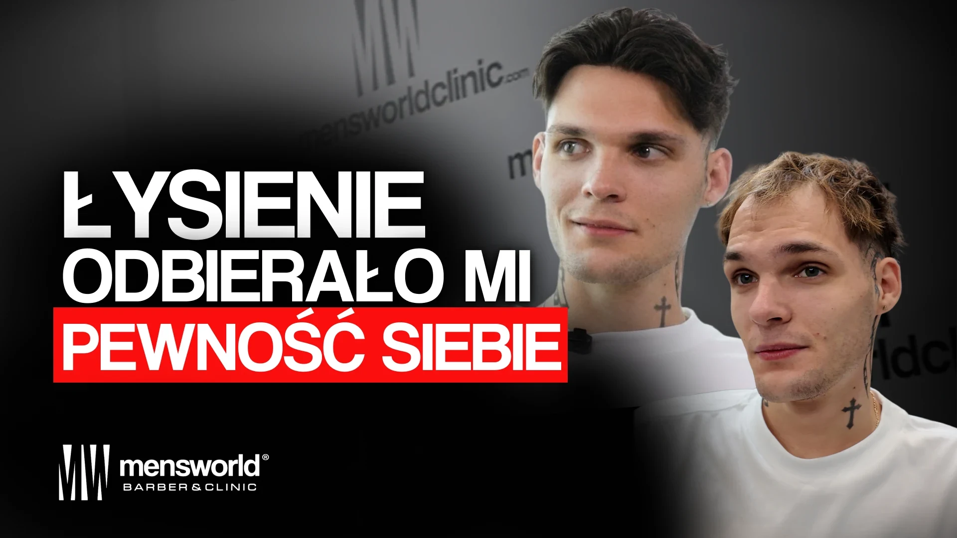Leszek w studiu MW Podcast, odcinek o ukrywaniu zakoli i rezygnacji z przeszczepu włosów