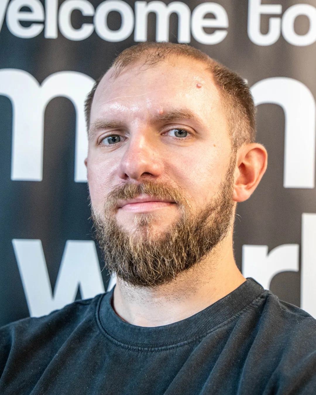 Piotr przed założeniem systemu włosów we Wrocławiu